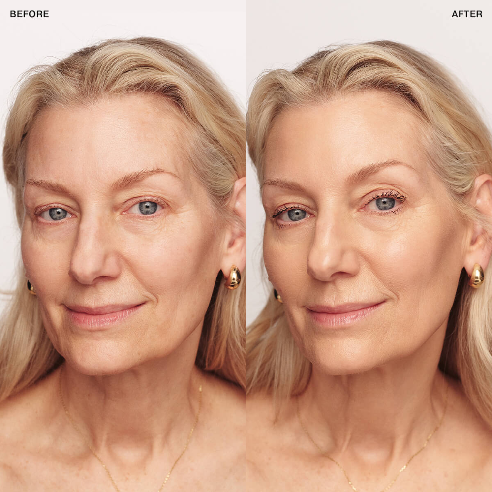 Lumea - Radiant Eye Corrector