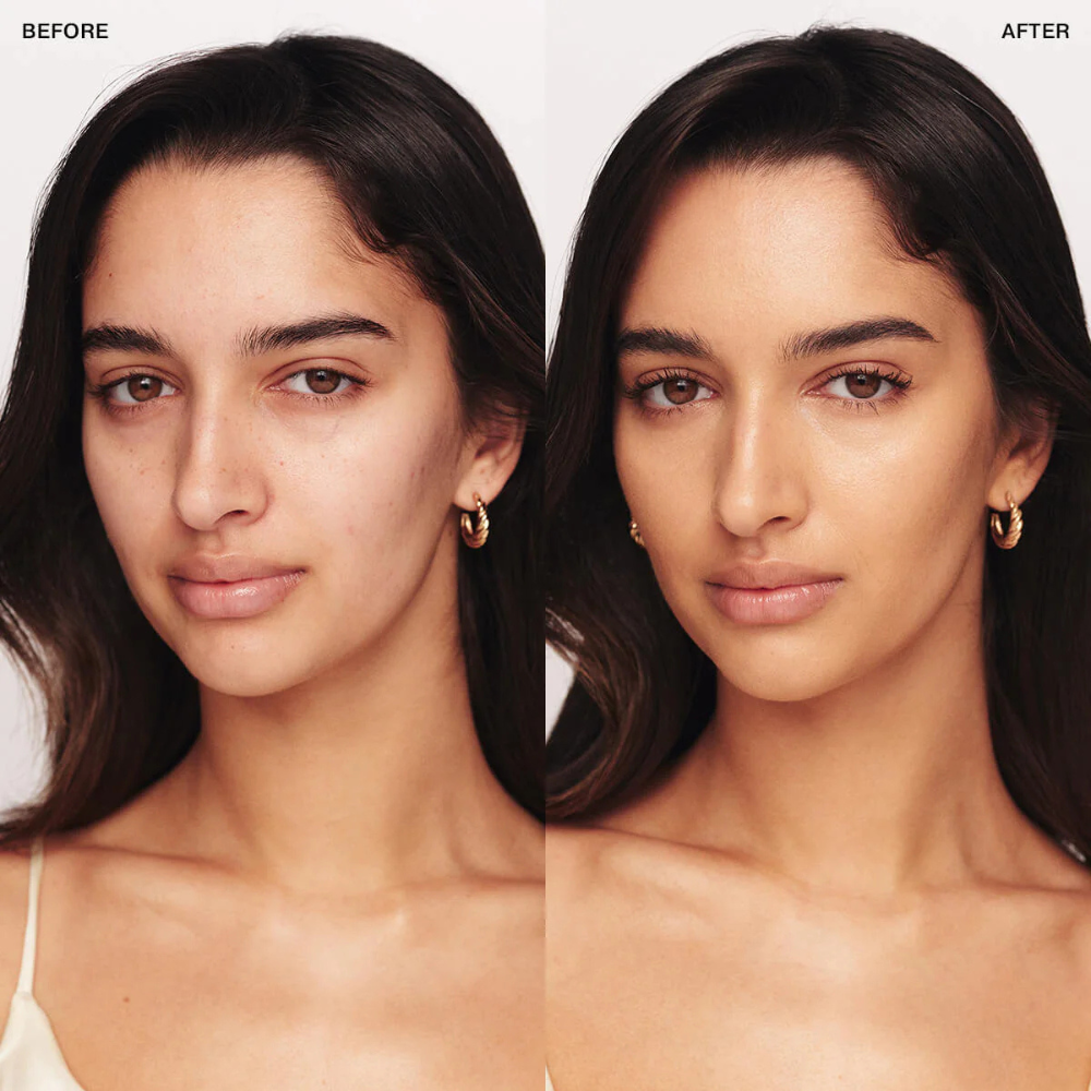 Lumea - Radiant Eye Corrector