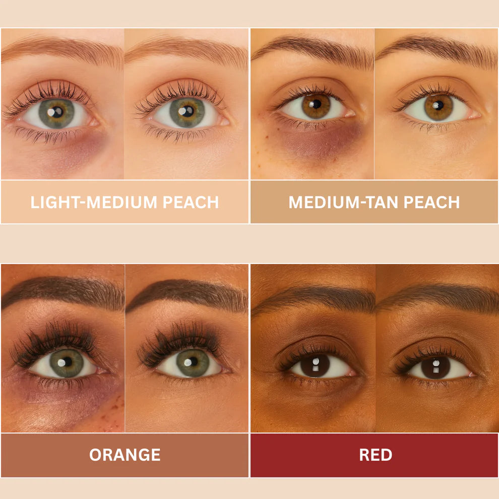 Lumea - Radiant Eye Corrector